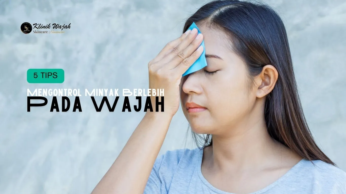 5 Tips Mengontrol Minyak Berlebih pada Wajah dengan Jenis Kulit Berminyak