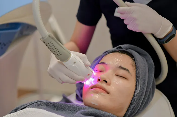 Apa Saja Manfaat Laser Wajah? 7 Beberapa Diantaranya!